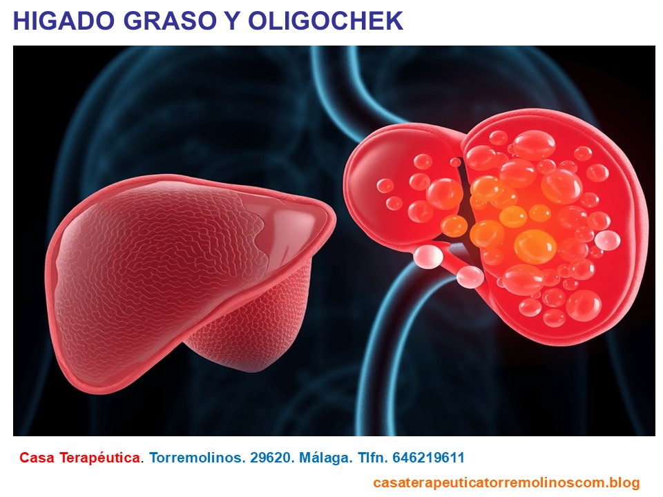 Hígado graso y&nbsp;Oligochek