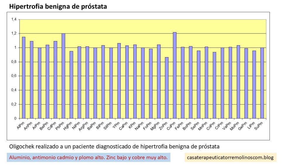 Hipertrofia Benigna de Próstata
